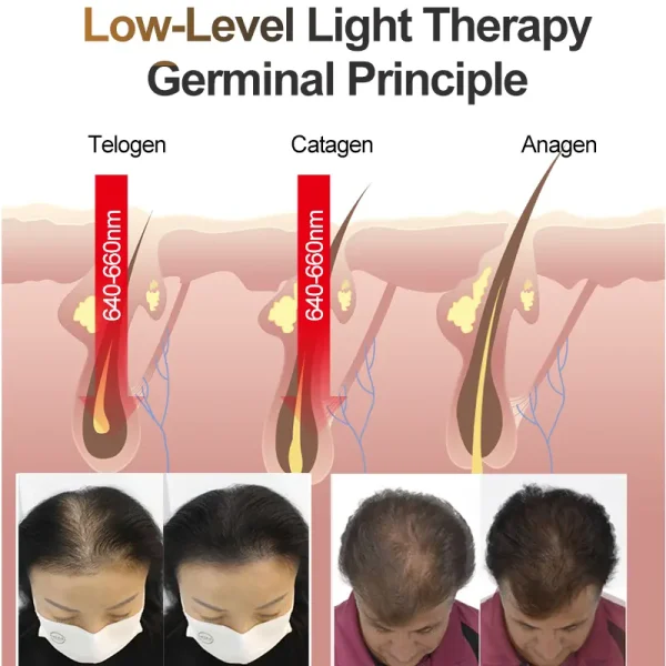 LS D620 hair growth helmet (4)