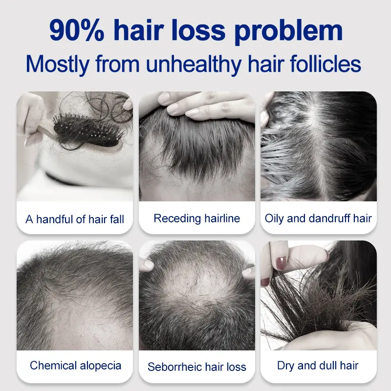 hair loss treatment